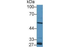 Western Blotting (WB) image for anti-Aldehyde Dehydrogenase 1 Family, Member A2 (ALDH1A2) (AA 1-422) antibody (ABIN7435901)