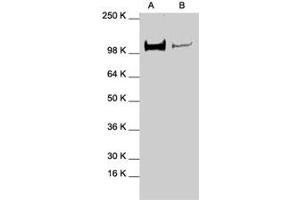 Western blot analysis of STAT2 polyclonal antibody  in expression in A-431 (A) and HeLa (B) whole cell lysates. (STAT2 antibody  (C-Term))