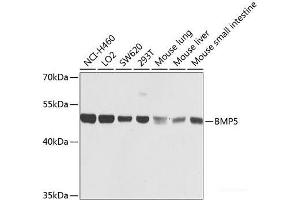 Western blot analysis of extracts of various cell lines using BMP5 Polyclonal Antibody at dilution of 1:1000. (BMP5 antibody)
