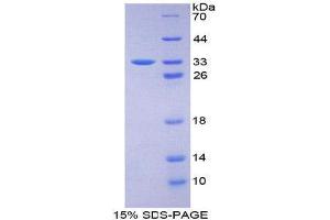 SDS-PAGE (SDS) image for Protein Kinase D1 (PRKD1) (AA 349-612) protein (His tag) (ABIN2126512) (PKC mu Protein (AA 349-612) (His tag))