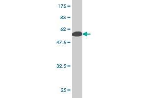 Western Blot detection against Immunogen (65. (PCBP2 antibody  (AA 1-362))