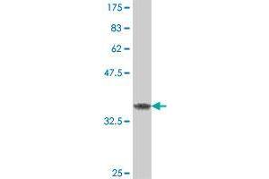 Western Blot detection against Immunogen (37. (FBXL3 antibody  (AA 1-100))