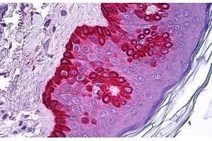 Human Skin: Formalin-Fixed, Paraffin-Embedded (FFPE) (CELA1 antibody)
