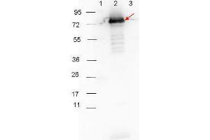 Western blot showing detection of 0. (Surface Lipoprotein p27 antibody)