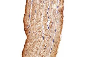 Immunohistochemical staining of formalin-fixed and paraffin-embedded human skeletal muscle section reacted with MAP4K3 monoclonal antibody  at 1:100 dilution.