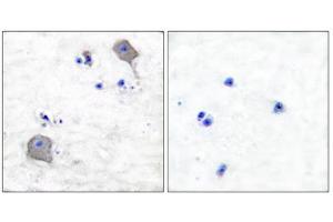 Immunohistochemical analysis of paraffin-embedded human brain tissue using Claudin 5 antibody (ABIN5976358).