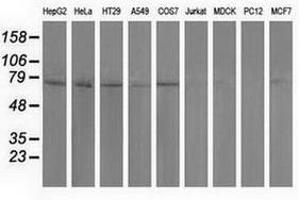 Image no. 2 for anti-Pseudouridylate Synthase 7 Homolog (PUS7) antibody (ABIN1500516) (PUS7 antibody)