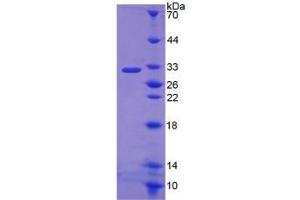 Image no. 1 for Nicotinamide Adenine Dinucleotide Phosphate Oxidase 3 (AA 221-466) protein (His tag) (ABIN4988515)