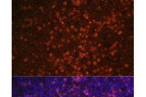 Immunofluorescence (IF) image for anti-Complement Component (3d/Epstein Barr Virus) Receptor 2 (CR2) antibody (ABIN7264437)