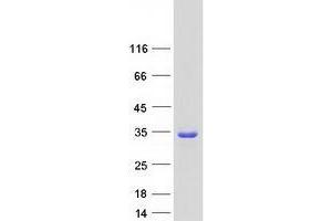 Tumor Protein D52-Like 2 (TPD52L2) (Transcript Variant 5) protein (Myc-DYKDDDDK Tag)