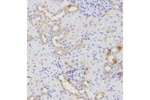 Immunohistochemistry (IHC) image for anti-ATG16 Autophagy Related 16-Like 1 (ATG16L1) (AA 90-300) antibody (ABIN1678769) (ATG16L1 antibody  (AA 90-300))