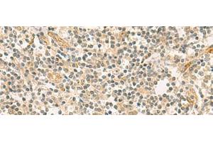 Immunohistochemistry of paraffin-embedded Human tonsil tissue using HHIPL2 Polyclonal Antibody at dilution of 1:55(x200) (HHIPL2 antibody)