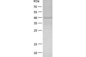 Western Blotting (WB) image for Fibulin 1 (FBLN1) (AA 555-680) protein (His-IF2DI Tag) (ABIN7122964) (Fibulin 1 Protein (FBLN1) (AA 555-680) (His-IF2DI Tag))