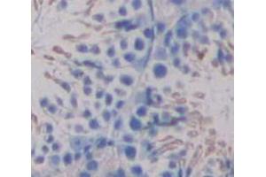 Figure. (UGT8 antibody  (AA 198-541))