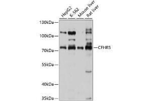 Western blot analysis of extracts of various cell lines, using CFHR5 antibody (ABIN6131938, ABIN6138459, ABIN6138460 and ABIN6214598) at 1:1000 dilution. (CFHR5 antibody  (AA 450-569))