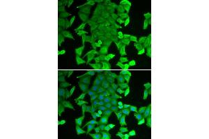Immunofluorescence analysis of MCF-7 cell using RFFL antibody. (RFFL antibody)