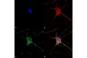 Immunocytochemistry/Immunofluorescence analysis using Mouse Anti-SUR1 Monoclonal Antibody, Clone S289-16 (ABIN2482985). (ABCC8 antibody  (AA 1548-1582) (Atto 390))