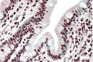 Immunohistochemistry (IHC) image for anti-Heterogeneous Nuclear Ribonucleoprotein A2/B1 (HNRNPA2B1) (Internal Region) antibody (ABIN1781995)