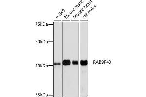 Western blot analysis of extracts of various cell lines, using RRP40 Rabbit mAb (ABIN7269816) at 1:1000 dilution. (RABEPK antibody)