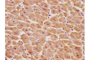 IHC image of ABIN7139700 diluted at 1:100 and staining in paraffin-embedded human heart tissue performed on a Leica BondTM system. (PSMD14 antibody  (Regulatory Subunit 14))