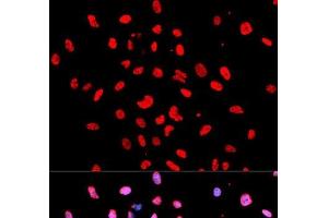 Immunofluorescence analysis of U2OS cells using Phospho-Btk(Y223) Polyclonal Antibody (BTK antibody  (pTyr223))