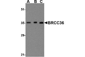 Western Blotting (WB) image for anti-BRCA1/BRCA2-Containing Complex, Subunit 3 (BRCC3) (N-Term) antibody (ABIN1031281) (BRCC3 antibody  (N-Term))