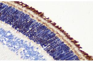 Immunohistochemistry of paraffin-embedded Mouse retina using PDE6B Polyclonal Antibody at dilution of 1:200 (40x lens). (PDE6B antibody)