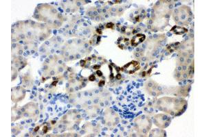 Anti- PGRMC1 Picoband antibody, IHC(P) IHC(P): Mouse Kidney Tissue (PGRMC1 antibody  (Middle Region))