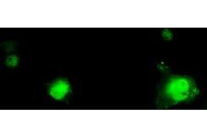 Image no. 1 for anti-Replication Protein A2, 32kDa (RPA2) antibody (ABIN1500739) (RPA2 antibody)