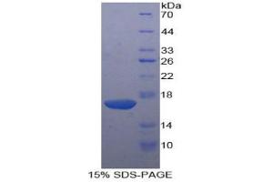 SDS-PAGE analysis of Human KLRB1 Protein.