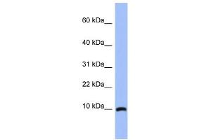 ACBD7 antibody used at 1 ug/ml to detect target protein. (ACBD7 antibody  (N-Term))