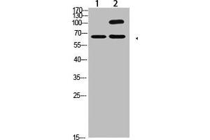 Western Blot analysis of 1,Hela 2,Mouse-kidney cells using primary antibody diluted at 1:2000(4 °C overnight). (COL13A1 antibody  (AA 41-90))