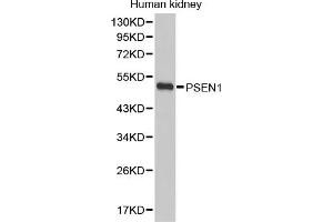 Western blot analysis of extracts of human kidney, using PSEN1 antibody (ABIN5971213). (Presenilin 1 antibody)