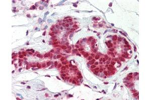 Anti-SNRPA antibody IHC of human breast. (SNRPA1 antibody  (AA 191-240))