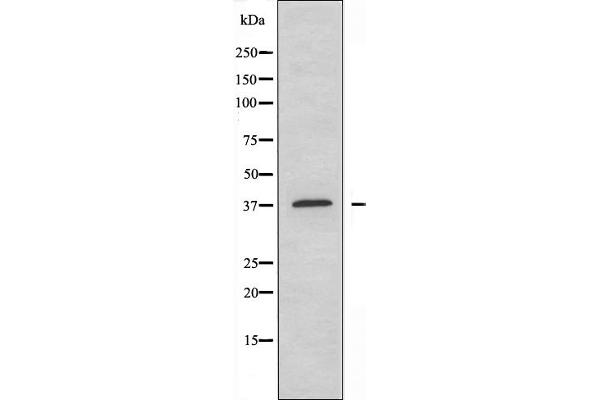 YBX2 antibody  (C-Term)