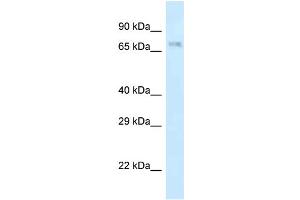 WB Suggested Anti-Apbb2 Antibody Titration: 1.