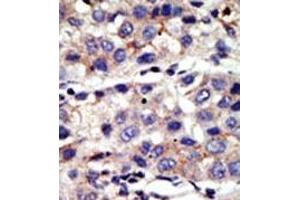 Image no. 2 for anti-Chromobox Homolog 4 (CBX4) (N-Term) antibody (ABIN357750) (CBX4 antibody  (N-Term))