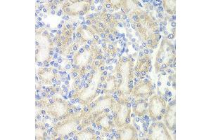 Immunohistochemistry (IHC) image for anti-Microtubule-Associated Protein 2 (MAP2) (AA 260-559) antibody (ABIN3016265) (MAP2 antibody  (AA 260-559))