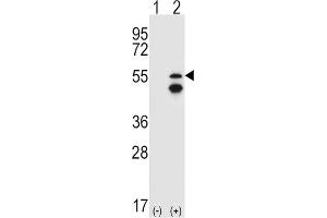 Western Blotting (WB) image for anti-Fyn-Related Kinase (FRK) antibody (ABIN3003444) (FRK antibody)