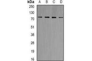 Western blot analysis of GlyRS expression in Jurkat (A), Raji (B), HT29 (C), mouse brain (D) whole cell lysates. (GlyRS antibody)