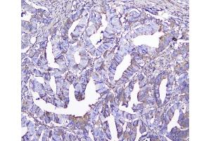 IHC analysis of GSTM1 using anti-GSTM1 antibody (ABIN5693233). (GSTM1 antibody)