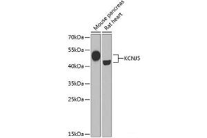 Western blot analysis of extracts of various cell lines using KCNJ5 Polyclonal Antibody at dilution of 1:1000. (KCNJ5 antibody)