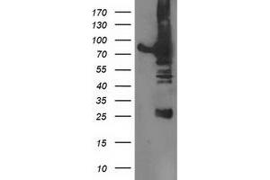 Western Blotting (WB) image for anti-Dipeptidyl-Peptidase 3 (DPP3) antibody (ABIN1497829) (DPP3 antibody)