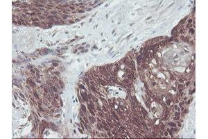 Image no. 1 for anti-Interferon Regulatory Factor 6 (IRF6) antibody (ABIN1498901) (IRF6 antibody)