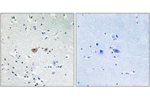 Immunohistochemistry analysis of paraffin-embedded human brain tissue, using FKHR (Ab-256) Antibody. (FOXO1 antibody  (AA 223-272))