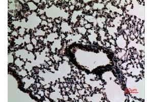 Immunohistochemistry (IHC) image for anti-Signal Transducer and Activator of Transcription 2, 113kDa (STAT2) (Tyr1221), (Tyr1222) antibody (ABIN6284459)