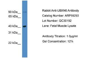 WB Suggested Anti-UBXN6  Antibody Titration: 0. (UBXN6 antibody  (C-Term))