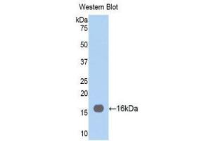 Western Blotting (WB) image for anti-Fascin (FSCN1) (AA 277-396) antibody (ABIN1858919) (Fascin antibody  (AA 277-396))