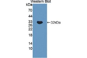 Figure. (TNXB antibody  (AA 3824-4071))