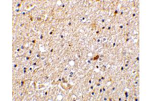 Immunohistochemistry (IHC) image for anti-Nerve Growth Factor Receptor (TNFRSF16) Associated Protein 1 (NGFRAP1) (Middle Region) antibody (ABIN1031007) (Nerve Growth Factor Receptor (TNFRSF16) Associated Protein 1 (NGFRAP1) (Middle Region) antibody)